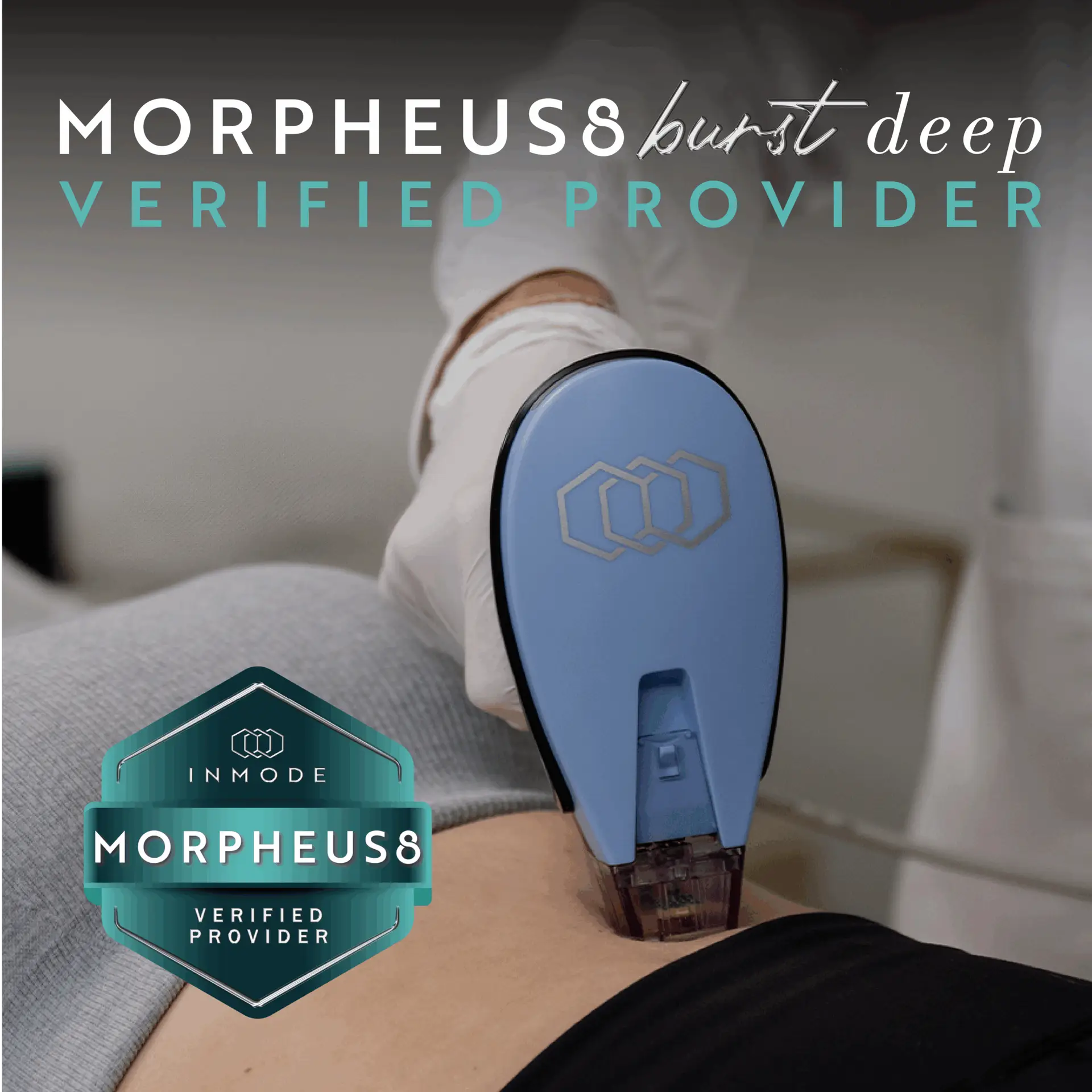 Morpheus8-Burst-Deep-treatment-being-applied-to-a-patient-with-verified-provider-badge.