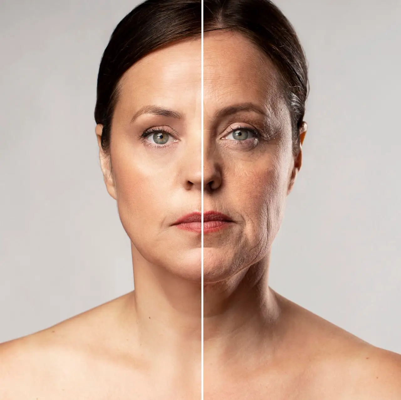 Before-and-after-results-showing-skin-tightening-treatment-reducing-wrinkles-and-fine-lines-on-woman's-face.